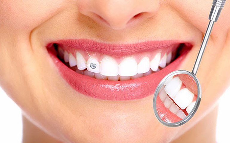 Dental jewellery treatment in Anand
                        