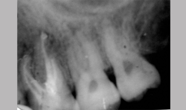 Orthodontic services in Anand
                            