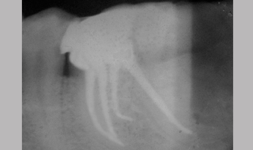 cosmetic dentistry treatment in Anand                        