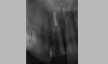 Cosmetic dentistry treatment in Anand                    