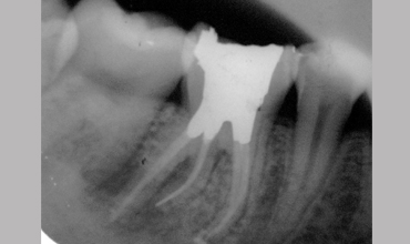 Dental hospital in Anand                    