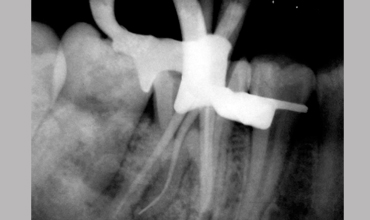 cosmetic dentistry treatment in Anand                    