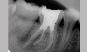 Cosmetic dentistry treatment in Anand                    